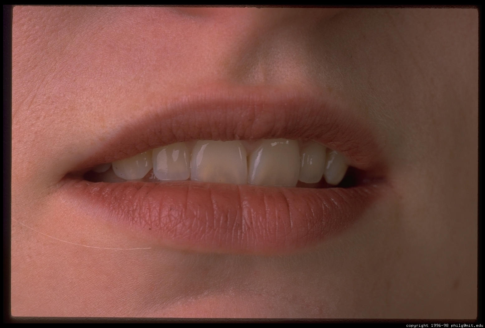 Photo Of Mouth 112